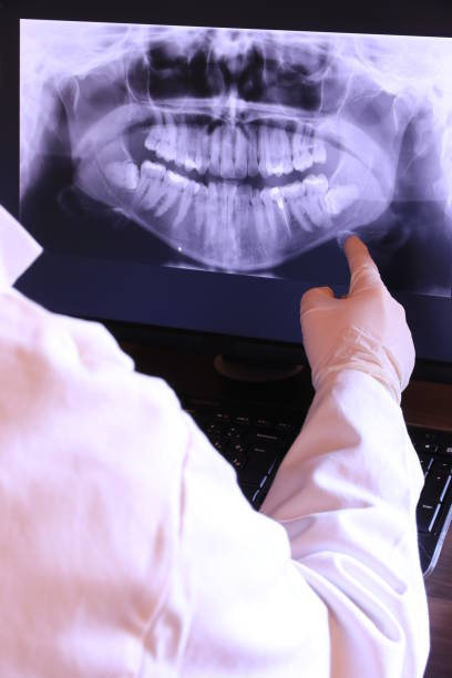Best Knocked-Out Tooth Emergency  in New Hope, AL