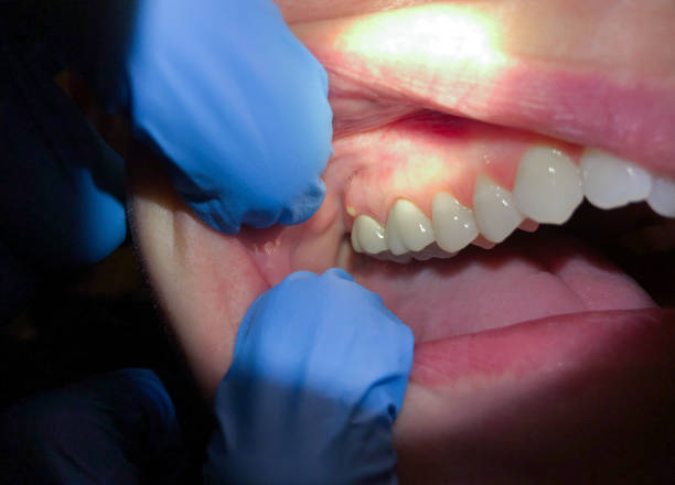 Best Tooth Infection Emergency Dentist  in New Hope, AL