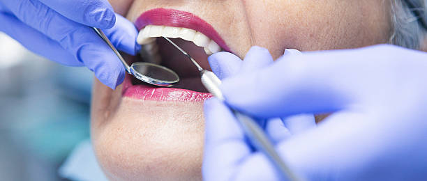 Best Dentist for Tooth Abscess  in New Hope, AL
